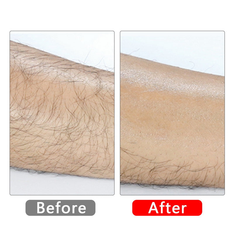 SkinFree
